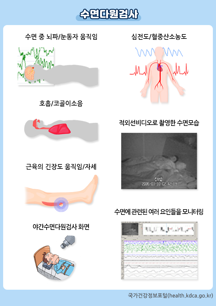 오포한의원 수면다원검사