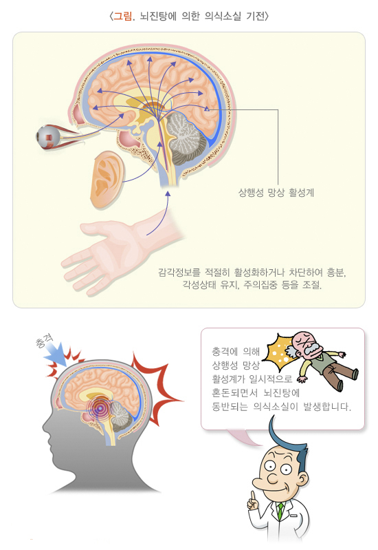 태전동 교통사고 위험 증상